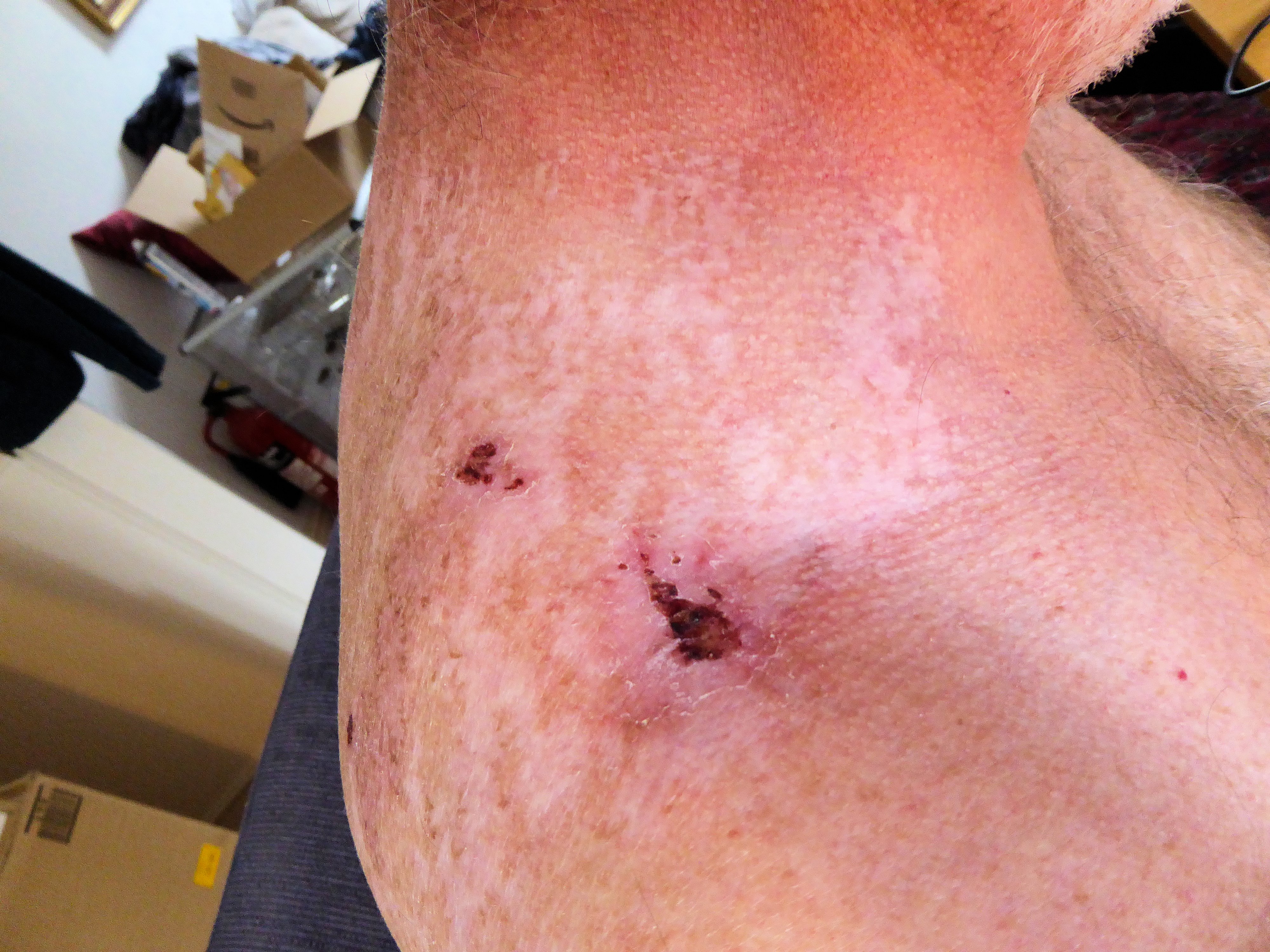 2021-10-12 Rshoulder1