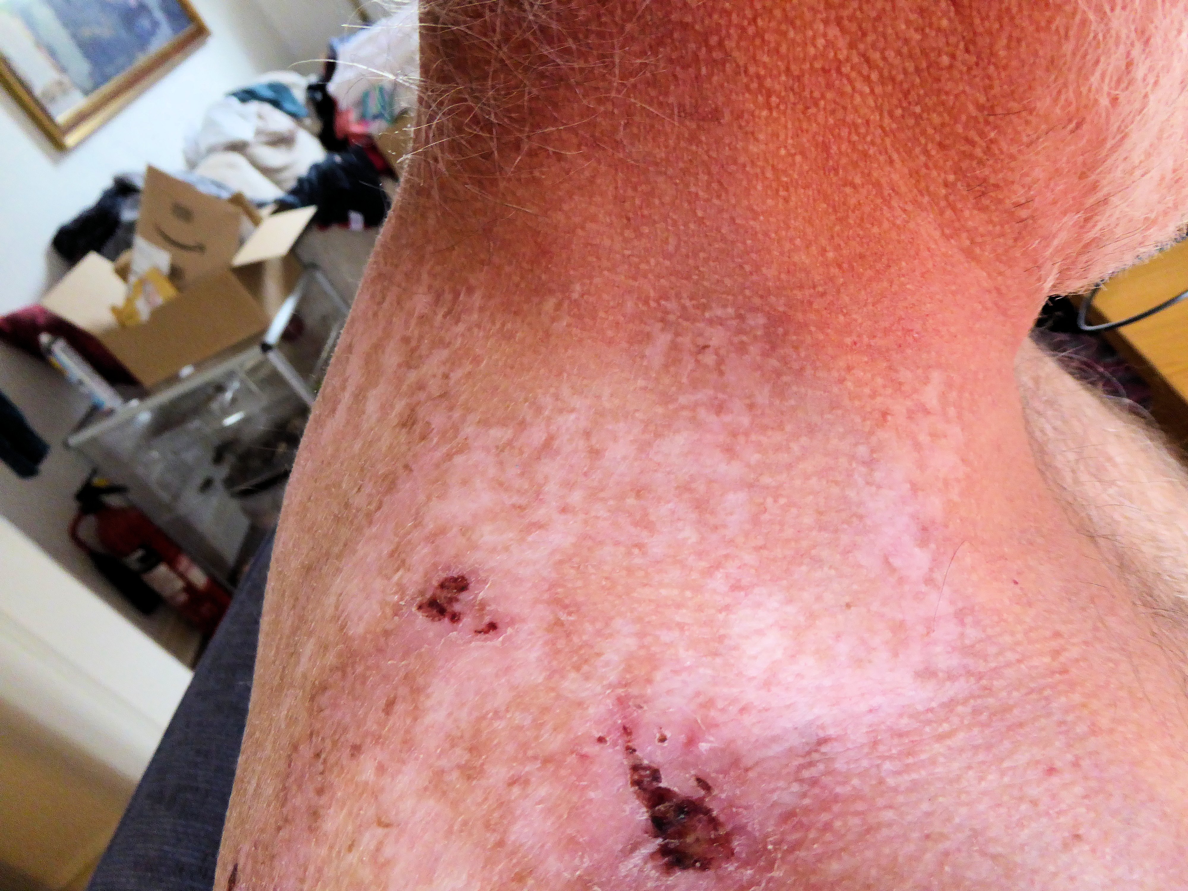 2021-10-12 Rshoulder2